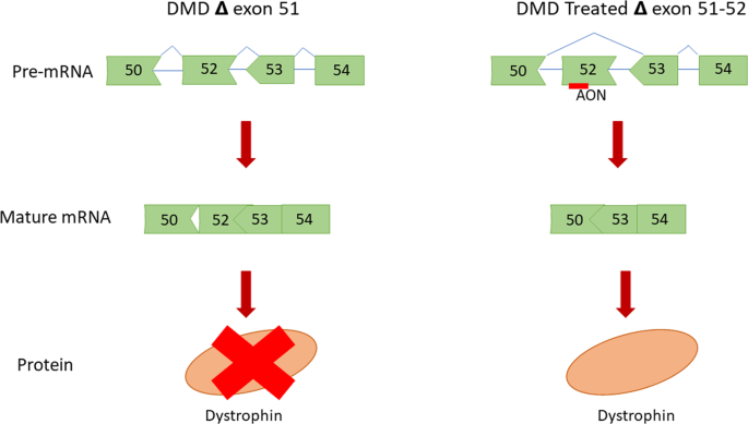 How exon-skipping works