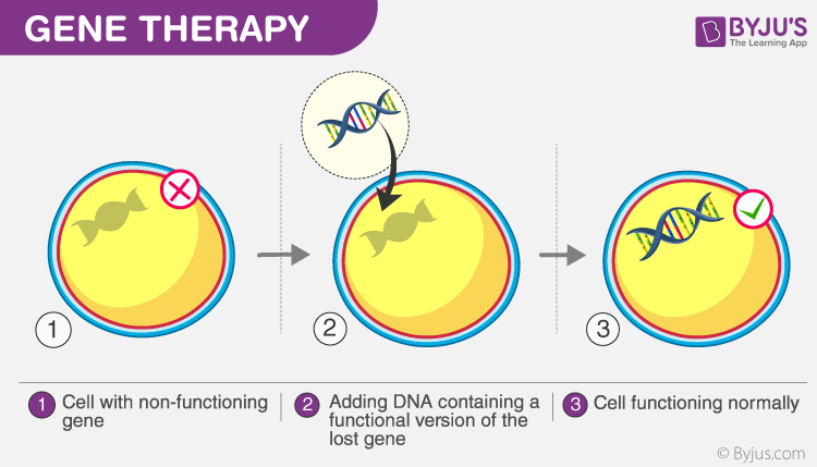 All you need to know about Gene Therapy