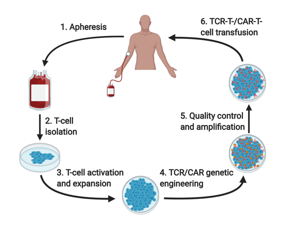 Flow chart of the steps involved in engineered T-cell therapy