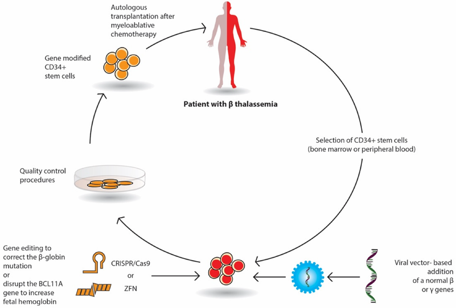 Cell Therapy Preparation schematic